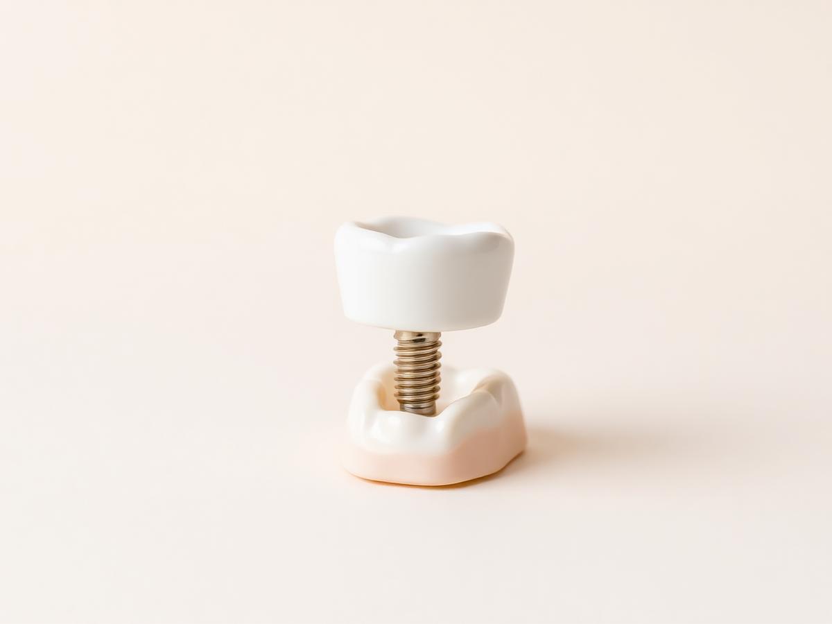Dental Implants
