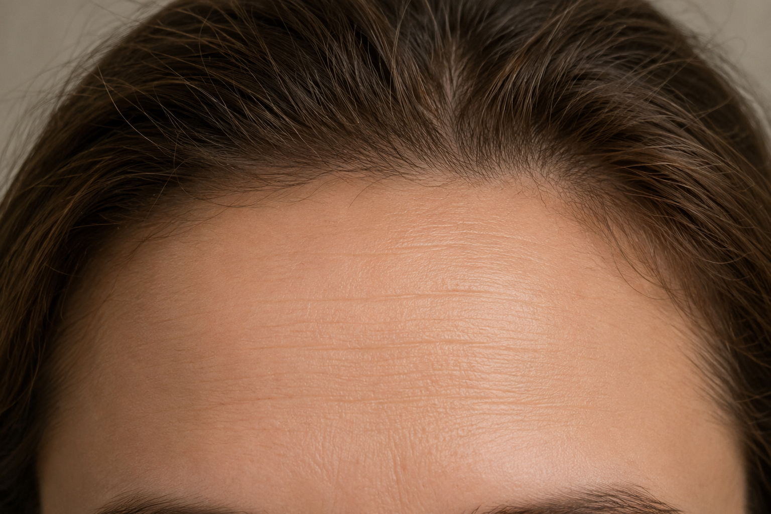 Anti Wrinkle Treatment — before
